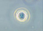 Ausgel�st wird diese durch Akantham�ben. In zystischer Form gelten Vertreter der Gattung als nahezu unverw�stlich. Wikimedia Commons